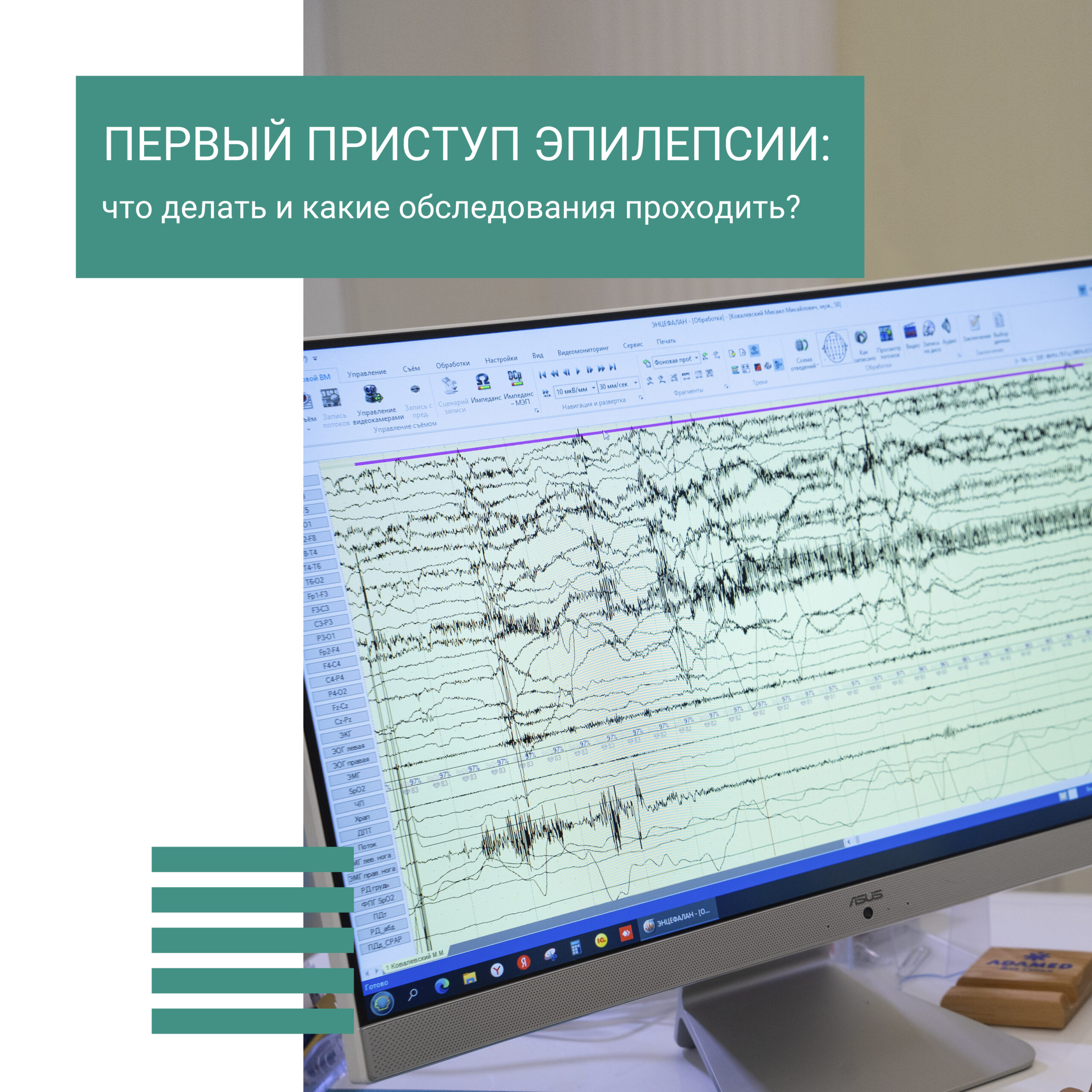 Первый приступ эпилепсии: что делать и какие обследования необходимы