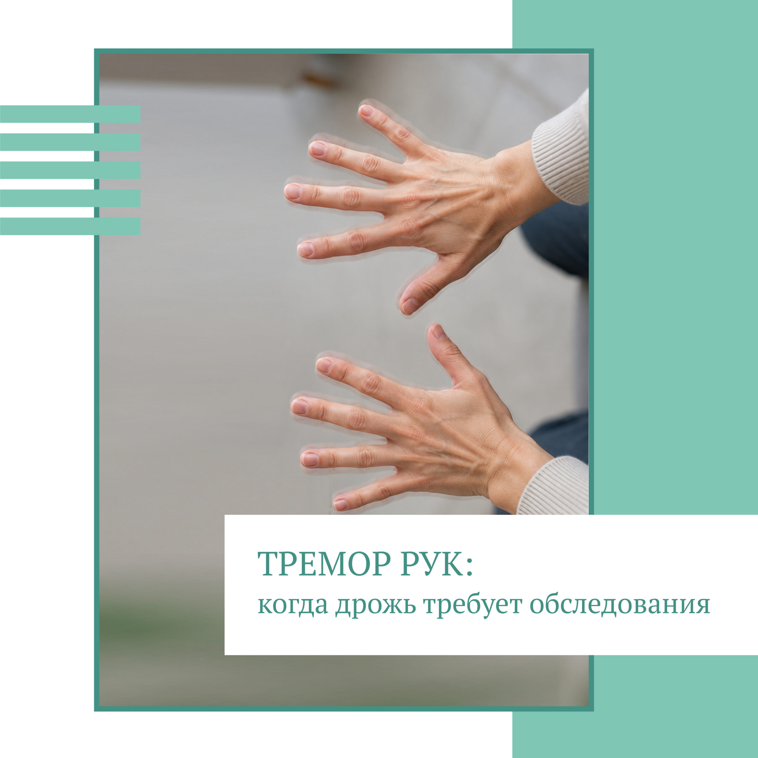Тремор рук: когда дрожь требует обследования